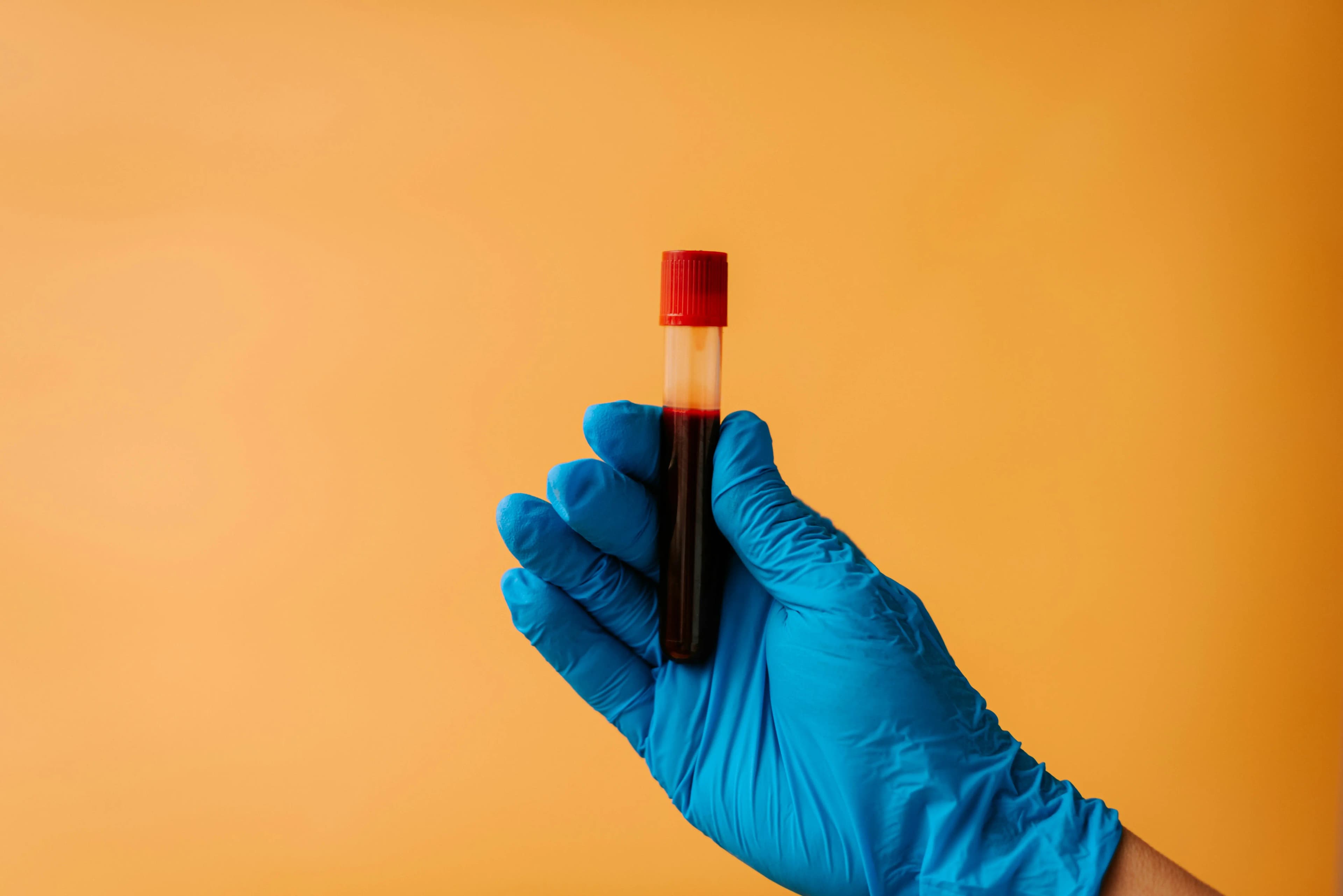 Så funkar kolesteroltestet